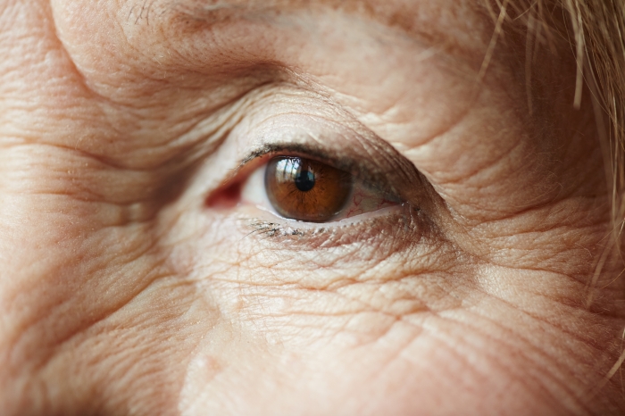 Suplementação com antioxidantes para o tratamento da degeneração macular